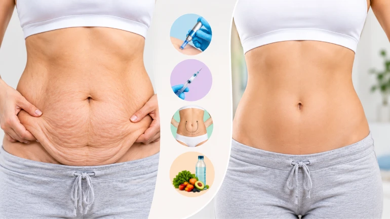 What Is the Best Treatment for Loose Skin After Pregnancy?