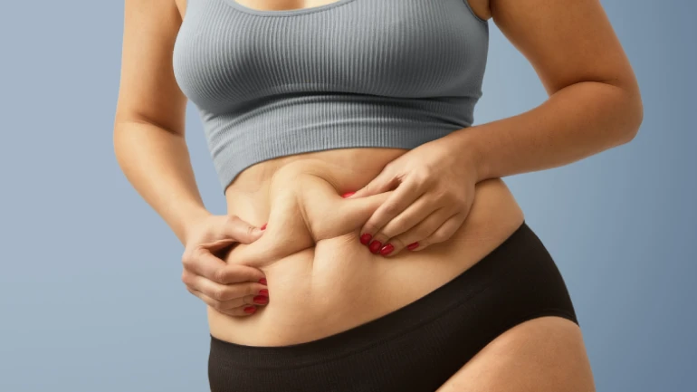 Liposuction Success Rate: What Results Can You Really Expect