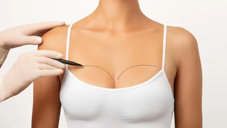 Breast Augmentation Side Effects, Complications & Common Problems