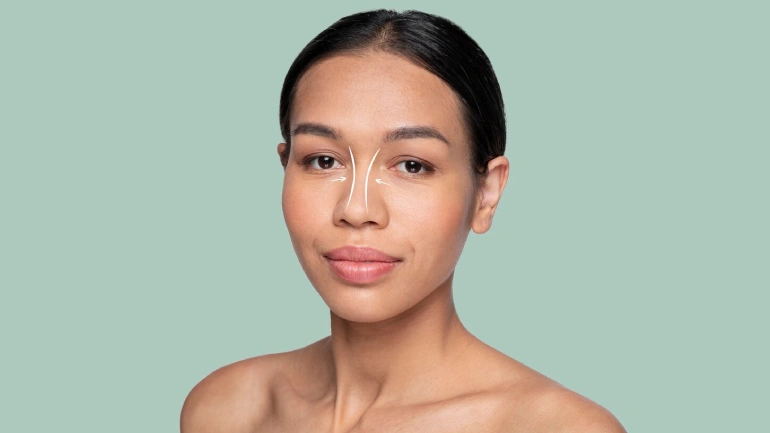 Closed Vs. Open Rhinoplasty: Which Technique Is Better?