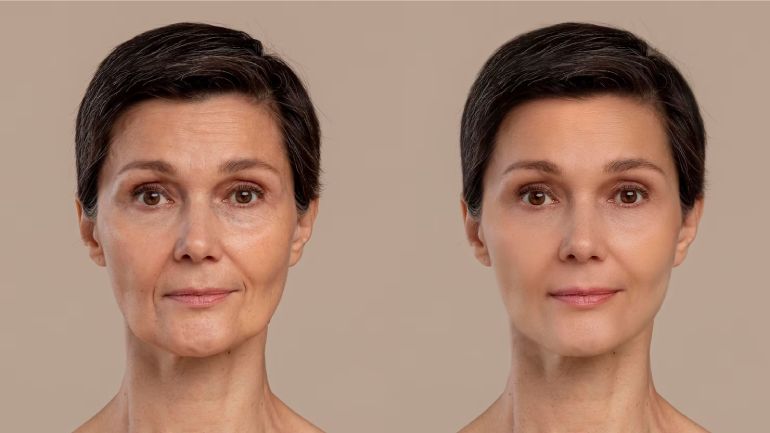 Surgical Face Makeovers