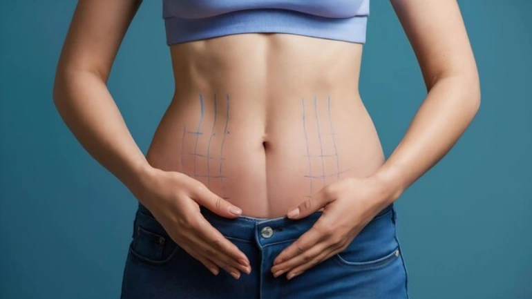 Liposuction Surgery: Areas Treated, Cost & Recovery Time