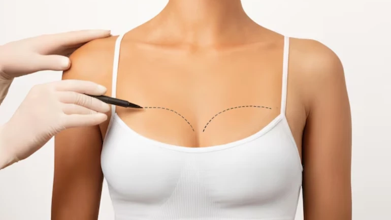 How to Choose the Best Clinic for Breast Reduction Surgery in Mumbai