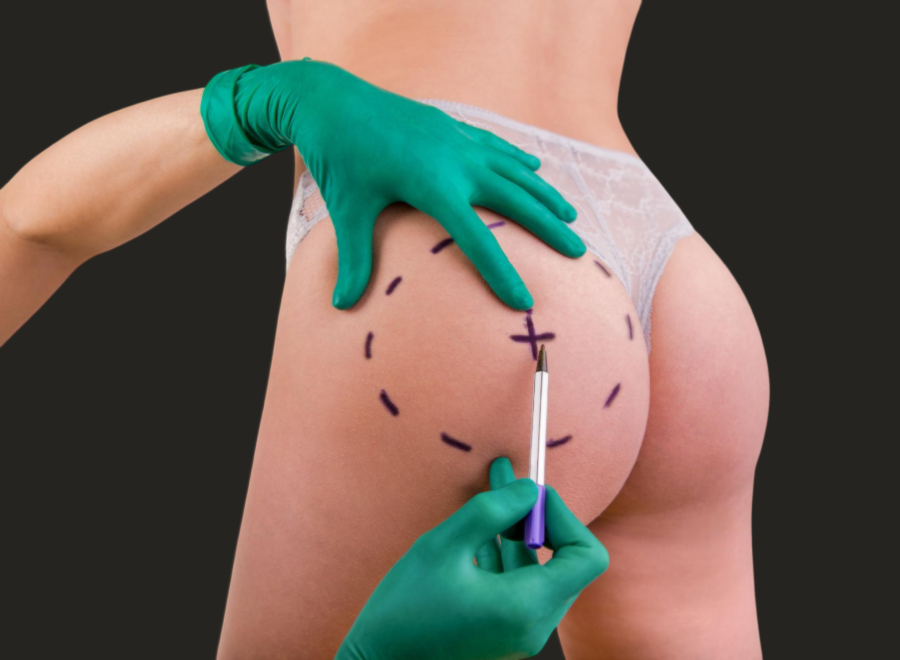 Silicone Butt Implants Surgery in Mumbai