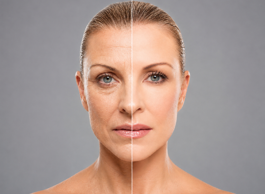 Face Rejuvenation Surgery in Mumbai