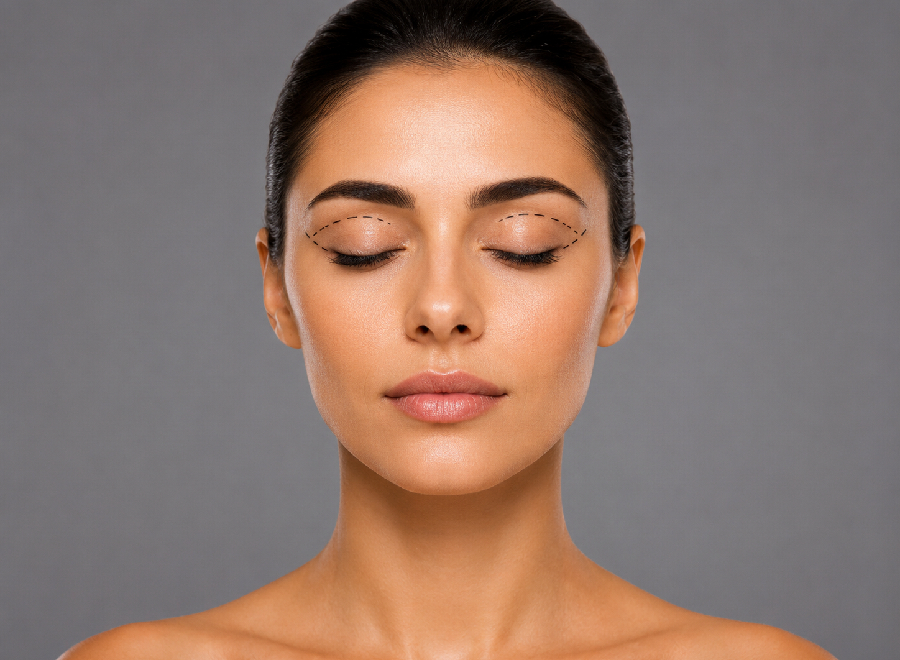 Blepharoplasty in Mumbai