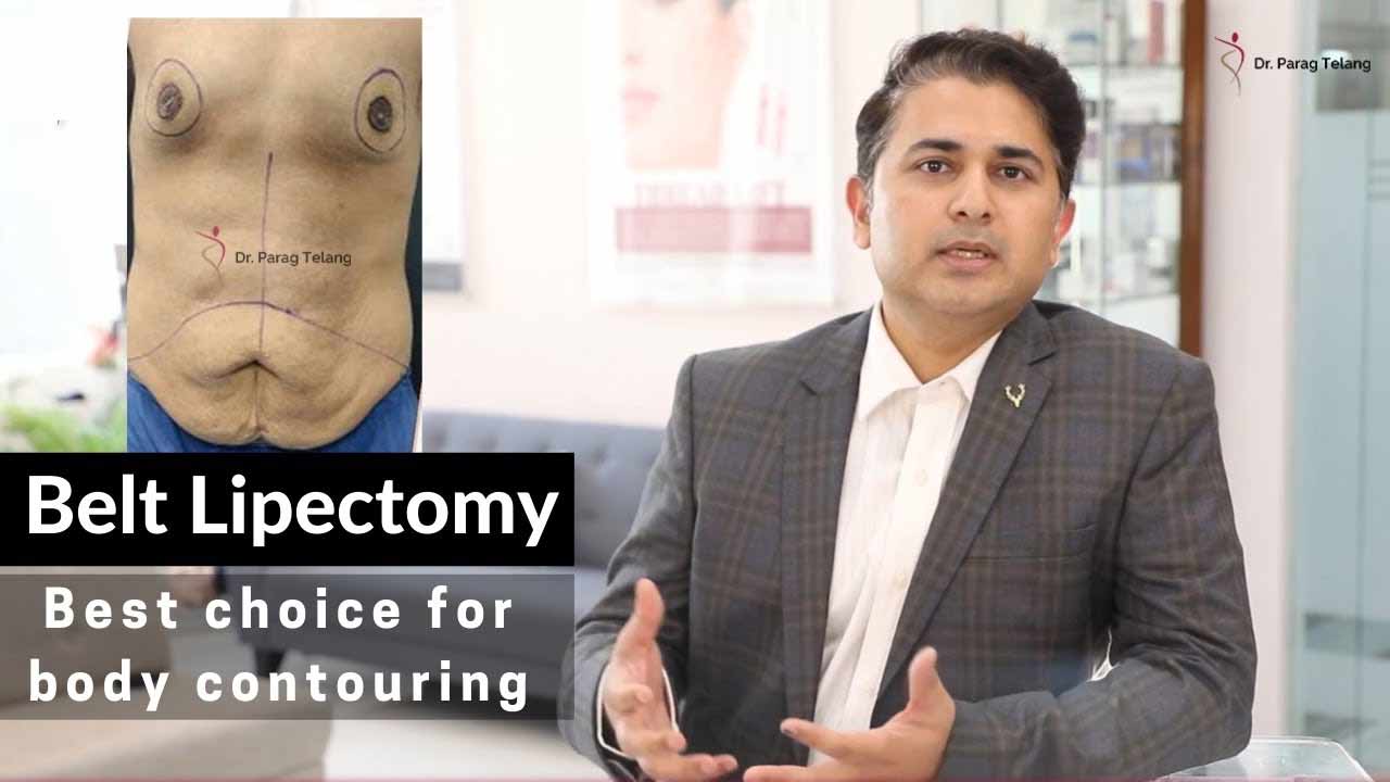 Belt Lipectomy Surgery Before After