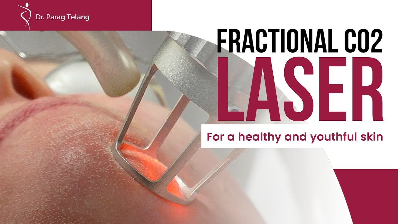 fractional_co2_laser
