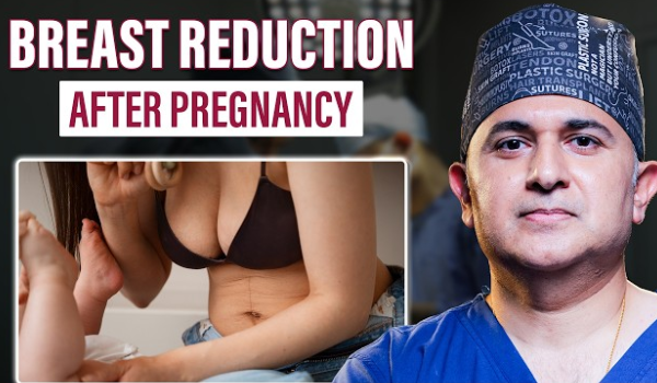 Breast Reduction Surgery | Breast Reduction After Pregnancy | When is the Right Time? | Dr. Parag
